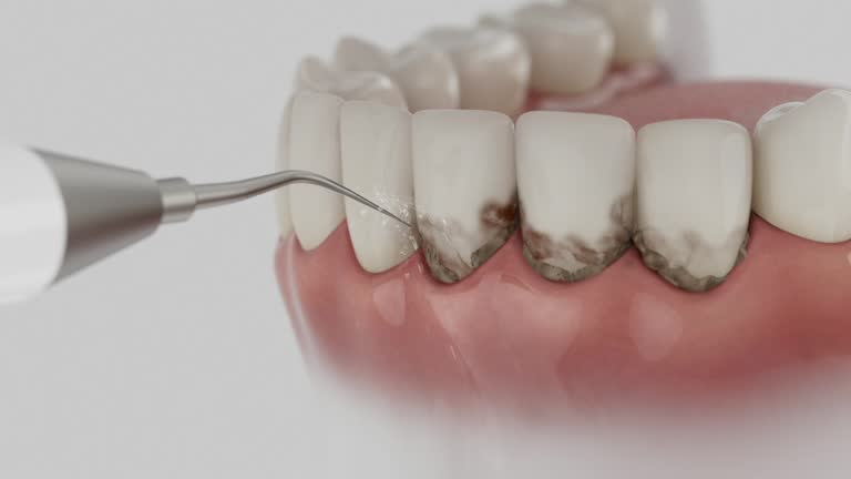 Trusted Wisdom Tooth Removal service in Metropolis, IL - Dentist Open Now